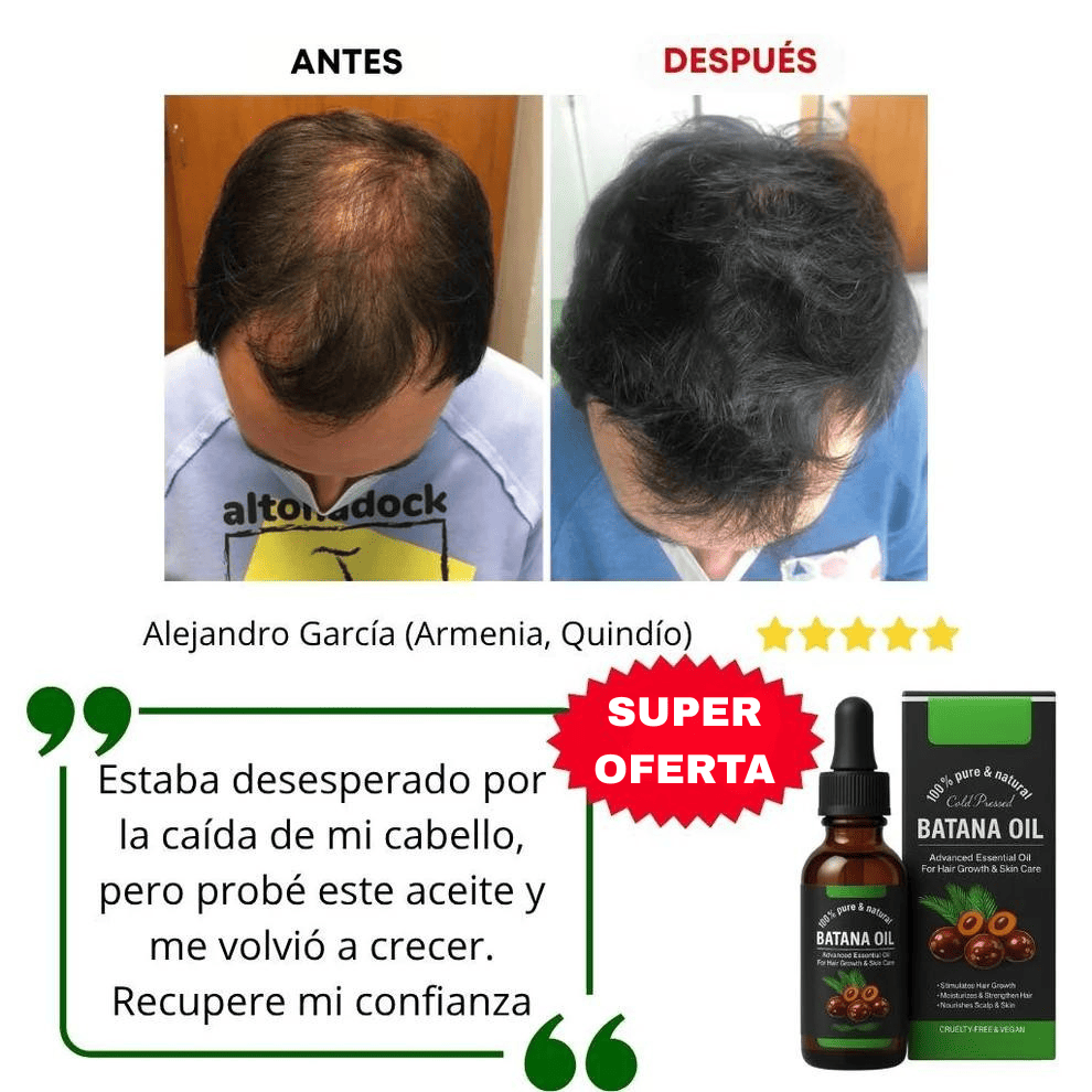 Aceite de Batana x2 | El Secreto para Prevenir la caída del cabello y Estimular el Crecimiento