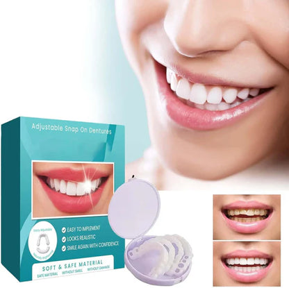 Carillas Prodental Snap On