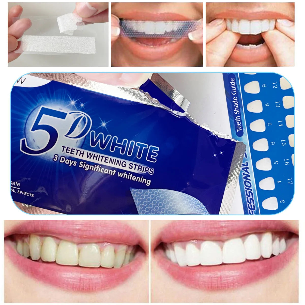 Tiras Blanqueadoras Dentales 14Pz