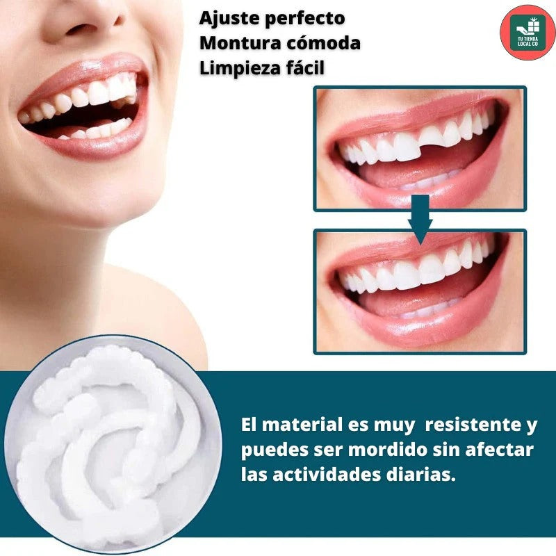 Carillas Prodental Snap On