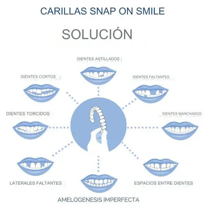 Carillas Prodental Snap On