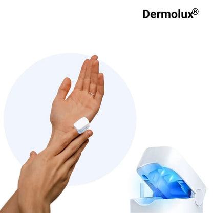 Dermolux® | Láser para tratamiento de hongos en las uñas