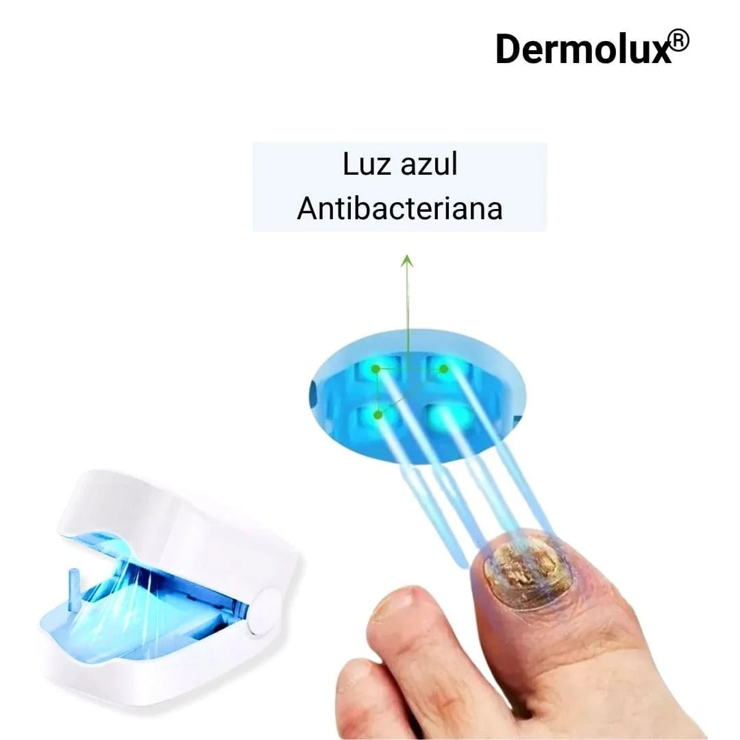 Dermolux® | Láser para tratamiento de hongos en las uñas