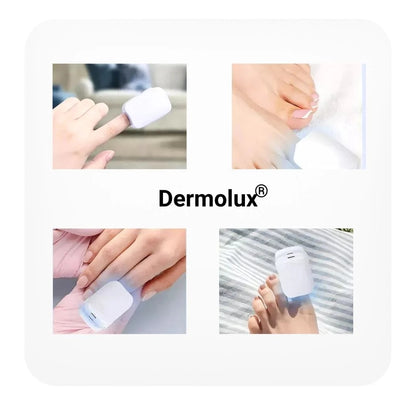 Dermolux® | Láser para tratamiento de hongos en las uñas