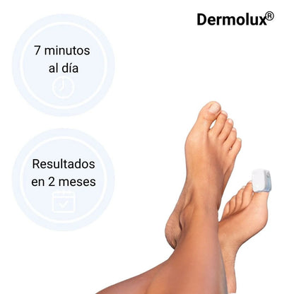 Dermolux® | Láser para tratamiento de hongos en las uñas