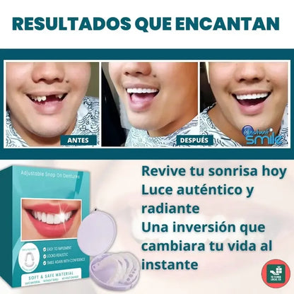 Carillas Prodental Snap On