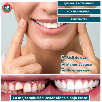 Carillas Prodental Snap On