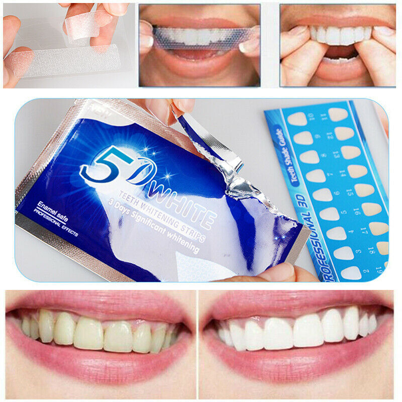 Tiras Blanqueadoras Dentales 14Pz