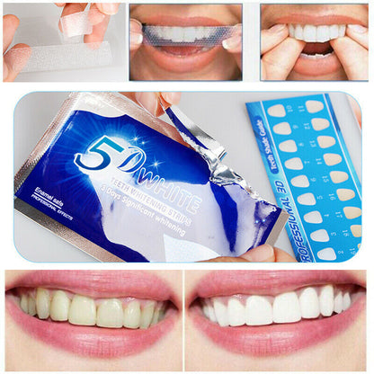 Tiras Blanqueadoras Dentales 14Pz