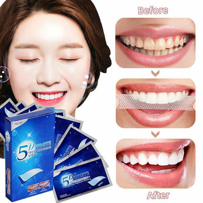 Tiras Blanqueadoras Dentales 14Pz