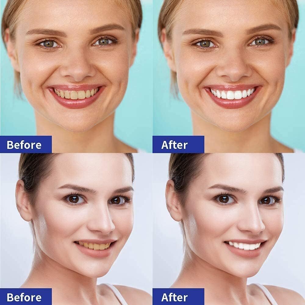 Tiras Blanqueadoras Dentales 14Pz
